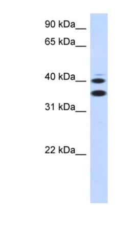 SLC25A32 Antibody, Novus Biologicals:Antibodies:Primary Antibodies