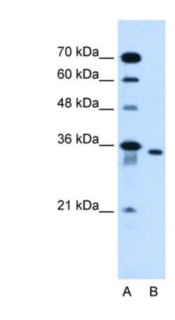 SLC25A32 Antibody, Novus Biologicals 0.05mg; Unlabeled:Antibodies, Polyclonal