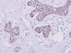 SLC25A33 Antibody, Novus Biologicals 0.1mg; Unlabeled:Antibodies, Polyclonal