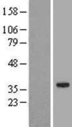 Novus Biologicals™ SLC25A33 Overexpression Lysate
