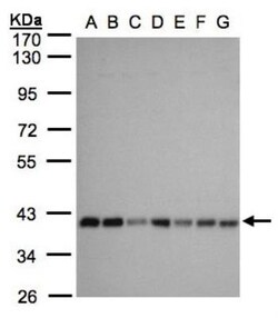 SLC25A33 Antibody, Novus Biologicals 0.1mg; Unlabeled:Antibodies, Polyclonal