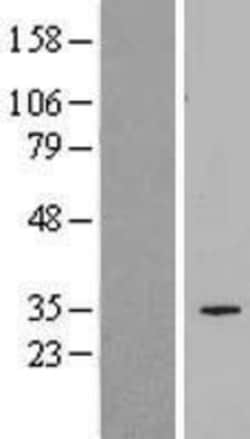 Novus Biologicals&trade;&nbsp;SLC25A34 Overexpression Lysate