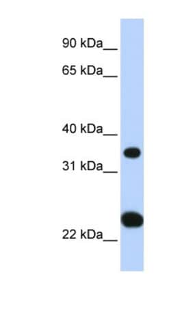 SLC25A35 Antibody, Novus Biologicals 0.05mg; Unlabeled:Antibodies, Polyclonal