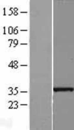Novus Biologicals&trade;&nbsp;SLC25A36 Overexpression Lysate