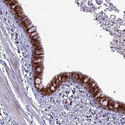 SLC25A37 Antibody, Novus Biologicals 25 &mu;L, Unlabeled:Antibodies, Polyclonal