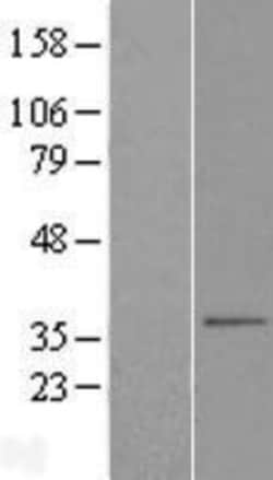 Novus Biologicals&trade;&nbsp;SLC25A38 Overexpression Lysate