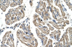 SLC25A38 Antibody, Novus Biologicals 0.05mg; Unlabeled:Antibodies, Polyclonal