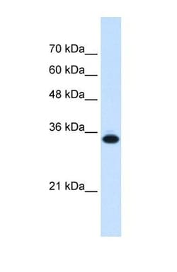 SLC25A38 Antibody, Novus Biologicals 0.05mg; Unlabeled:Antibodies, Polyclonal