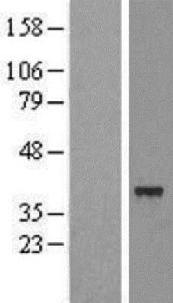 Novus Biologicals&trade;&nbsp;SLC25A39 Overexpression Lysate