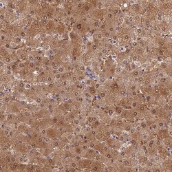SLC25A41 Antibody, Novus Biologicals 0.1mL; Unlabeled:Antibodies, Polyclonal