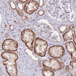 SLC25A42 Antibody, Novus Biologicals:Antibodies:Primary Antibodies