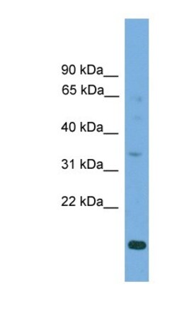 SLC25A44 Antibody, Novus Biologicals 100 &mu;L | Buy Online | Novus Biologicals | Fisher Scientific
