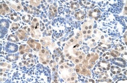 SLC25A45 Antibody, Novus Biologicals 100&mu;L; Unlabeled:Antibodies, Polyclonal