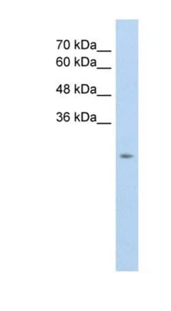 SLC25A45 Antibody, Novus Biologicals 100&mu;L; Unlabeled:Antibodies, Polyclonal