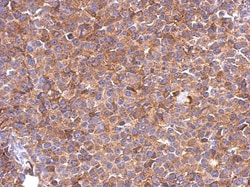 SLC25A46 Antibody, Novus Biologicals 0.1mL; Unlabeled:Antibodies, Polyclonal