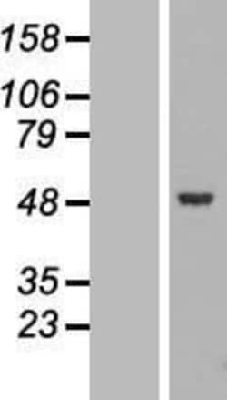 Novus Biologicals&trade;&nbsp;SLC25A46 Overexpression Lysate