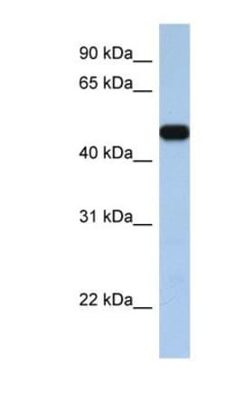 SLC25A46 Antibody, Novus Biologicals 0.05mg; Unlabeled:Antibodies, Polyclonal
