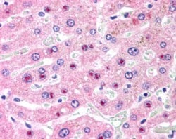 SLC25A47 Antibody, Novus Biologicals 0.1mg; Unlabeled:Antibodies, Polyclonal