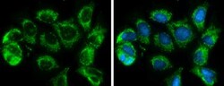 SLC25A6 Antibody, Novus Biologicals 0.1mL; Unlabeled:Antibodies, Polyclonal