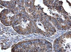 SLC25A6 Antibody, Novus Biologicals 0.1mL; Unlabeled:Antibodies, Polyclonal