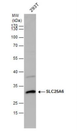 SLC25A6 Antibody, Novus Biologicals 0.1mL; Unlabeled:Antibodies, Polyclonal