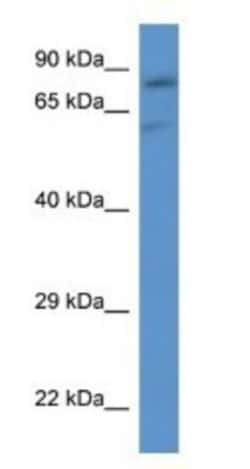 SLC26A2 Antibody, Novus Biologicals:Antibodies:Primary Antibodies