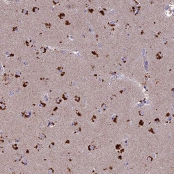 SLC26A4 Antibody, Novus Biologicals:Antibodies:Primary Antibodies
