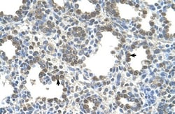 SLC26A5 Antibody, Novus Biologicals 0.1mg; Unlabeled:Antibodies, Polyclonal