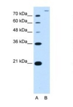 SLC26A5 Antibody, Novus Biologicals 0.1mg; Unlabeled:Antibodies, Polyclonal