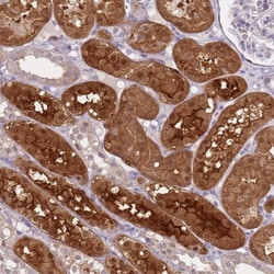 SLC26A6 Antibody, Novus Biologicals:Antibodies:Primary Antibodies
