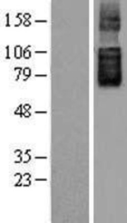 Novus Biologicals&trade;&nbsp;SLC26A6 Overexpression Lysate