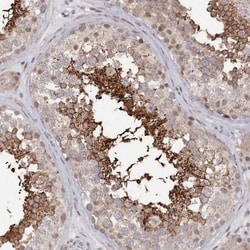 SLC26A8 Antibody, Novus Biologicals 0.1mL; Unlabeled:Antibodies, Polyclonal