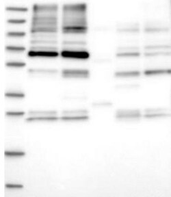 SLC26A8 Antibody, Novus Biologicals 0.1mL; Unlabeled:Antibodies, Polyclonal