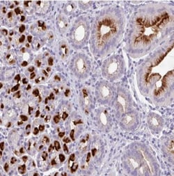 SLC26A9 Antibody, Novus Biologicals:Antibodies:Primary Antibodies