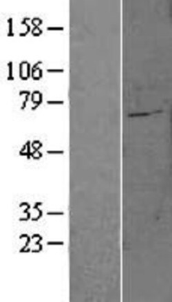 Novus Biologicals&trade;&nbsp;FATP6/SLC27A6 Overexpression Lysate