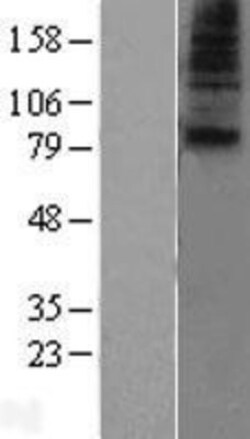 Novus Biologicals&trade;&nbsp;SLC28A1 Overexpression Lysate