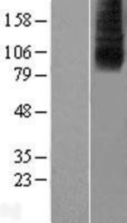 Novus Biologicals&trade;&nbsp;SLC28A2 Overexpression Lysate