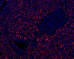 SLC28A3 Antibody, Novus Biologicals 0.1mL; Unlabeled:Antibodies, Polyclonal