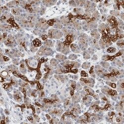 SLC28A3 Antibody, Novus Biologicals 0.1mL; Unlabeled:Antibodies, Polyclonal