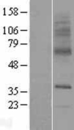 Novus Biologicals&trade;&nbsp;SLC29A3 Overexpression Lysate