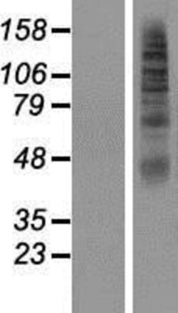 Novus Biologicals™ SLC2A11 Overexpression Lysate
