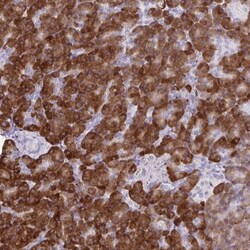 SLC30A3 Antibody, Novus Biologicals 25 &mu;L | Buy Online | Novus Biologicals | Fisher Scientific