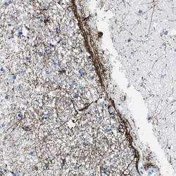 SLC30A4 Antibody, Novus Biologicals 0.1mL; Unlabeled:Antibodies, Polyclonal