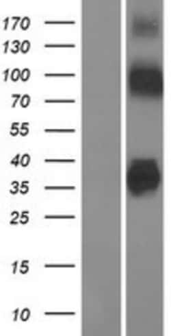 Novus Biologicals™ ZnT-8/SLC30A8 Overexpression Lysate