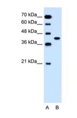 SLC35B1 Antibody, Novus Biologicals 0.1mg; Unlabeled:Antibodies, Polyclonal