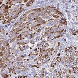 SLC35B1 Antibody, Novus Biologicals:Antibodies:Primary Antibodies