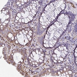 SLC35B1 Antibody, Novus Biologicals:Antibodies:Primary Antibodies