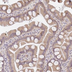SLC35B3 Antibody, Novus Biologicals 0.1mL; Unlabeled:Antibodies, Polyclonal