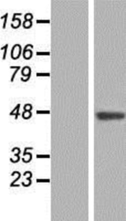 Novus Biologicals&trade;&nbsp;SLC35B3 Overexpression Lysate