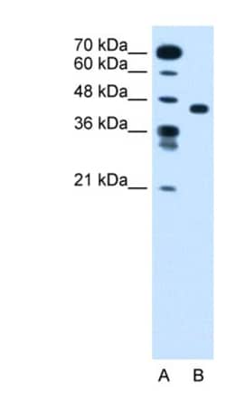 SLC35C1 Antibody, Novus Biologicals 0.1mg; Unlabeled:Antibodies, Polyclonal